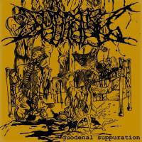 Hydropsy : Duodenal Suppuration